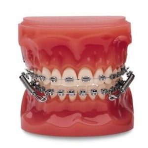 FORSUS EZ2 25MM S 1 KIT 3M