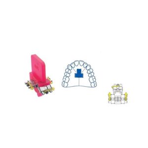 TORNILLO TRIDIRECCIONAL TRES PUNTAS 4MM 1U LEONE
